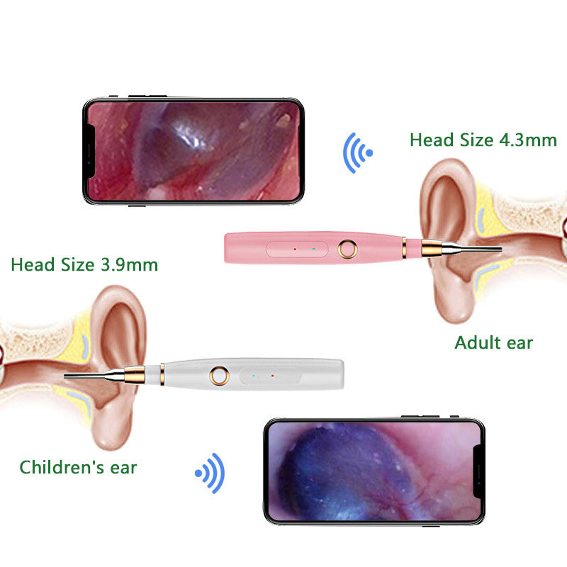 wireless ear otoscope